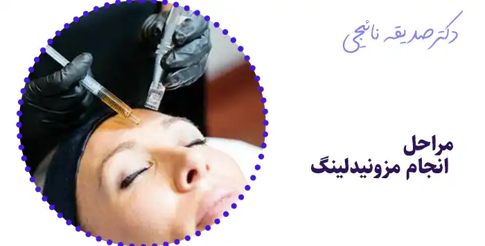 مراحل انجام مزونیدلینگ