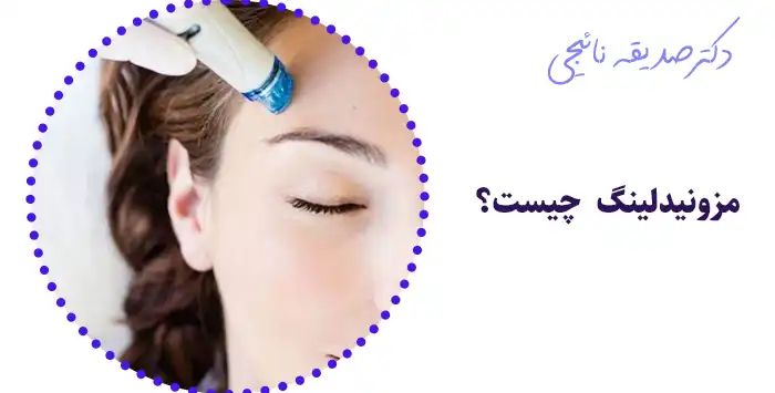 مزونیدلینگ چیست