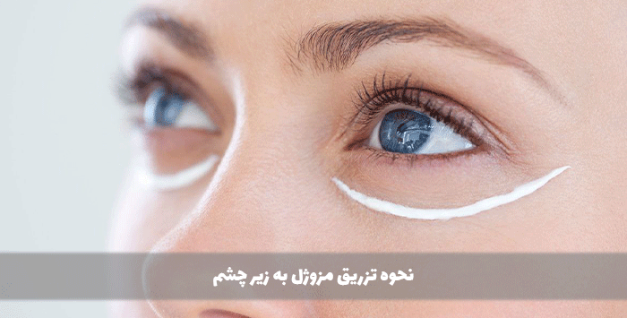 نحوه تزریق مزوژل به زیر چشم