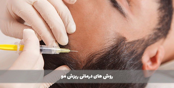 روش های درمانی ریزش مو