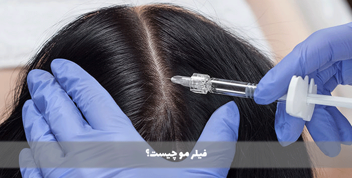 فیلر مو چیست؟