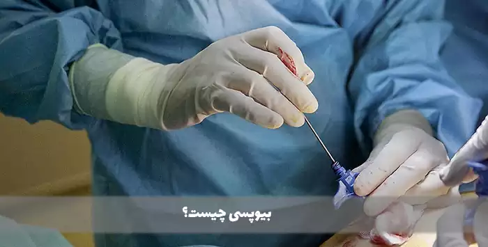 بیوپسی چیست؟