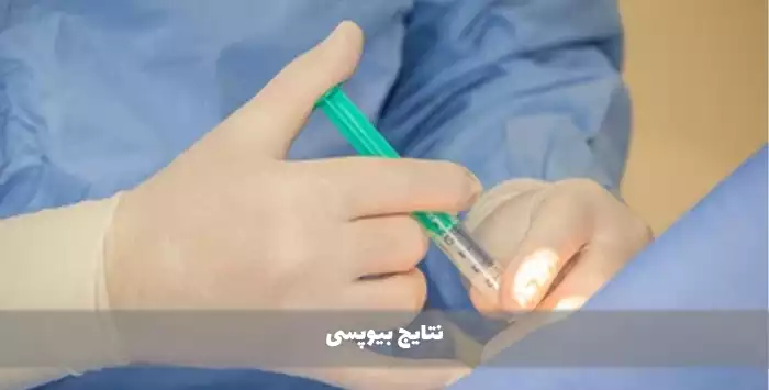 نتایج بیوپسی