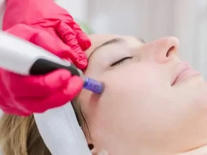 مزونیدلینگ