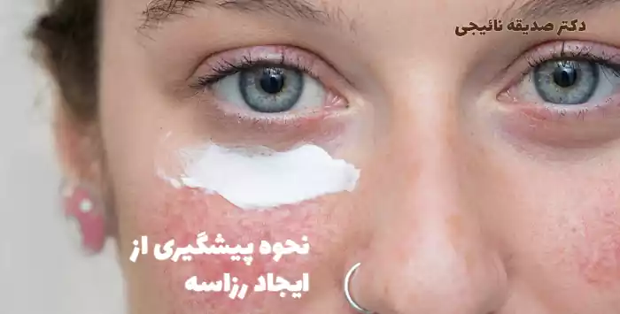 نحوه پیشگیری از ایجاد رزاسه