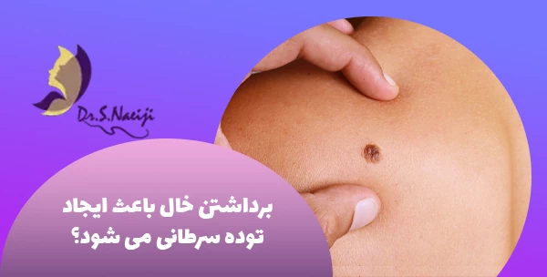 برداشتن خال باعث ایجاد توده سرطانی می شود؟