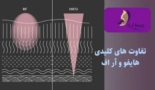 تفاوت های کلیدی هایفو و آر اف