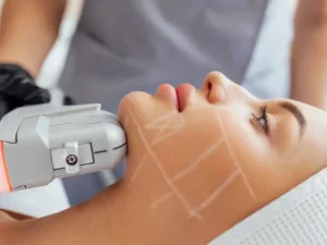 تفاوت هایفو و آر اف