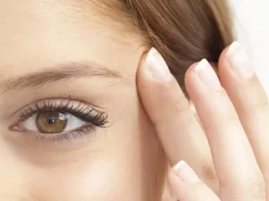 بوتاكس چشم گربه ای