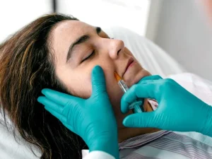 بوتاکس خط خنده