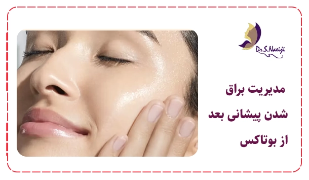 راهکارهای مدیریت براق شدن پیشانی بعد از بوتاکس