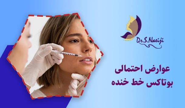 عوارض احتمالی بوتاکس خط خنده