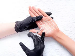 بوتاکس کف دست