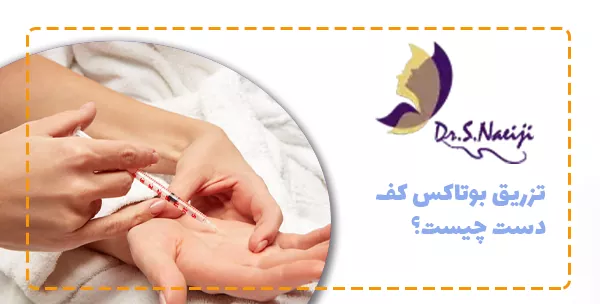 تزریق بوتاکس کف دست چیست؟