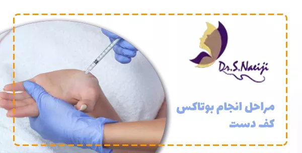 مراحل انجام بوتاکس کف دست