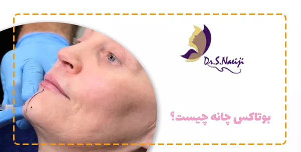 بوتاکس چانه چیست؟