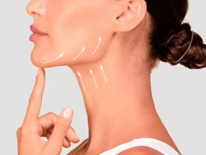 بوتاکس گردن