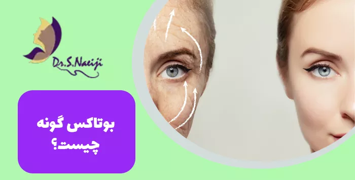 بوتاکس گونه چیست