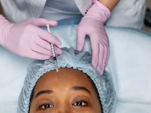 ماندگاری بوتاکس