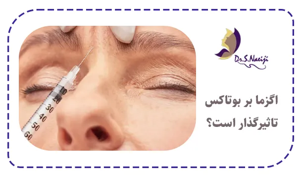 اگزما بر بوتاکس تاثیرگذار است؟