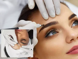 میکروبلیدینگ بعد از بوتاکس