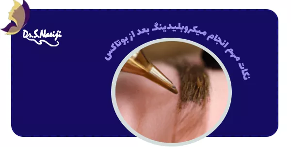 نکات مهم انجام میکروبلیدینگ بعد از بوتاکس